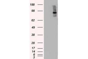 Image no. 4 for anti-B-Raf proto-oncogene, serine/threonine kinase (BRAF) antibody (ABIN1496954)