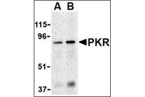 Western blot analysis of PKR in Caco-2 whole cell lysate with this product at (A) 1 and (B) 2 μg/ml. (EIF2AK2 抗体  (N-Term))