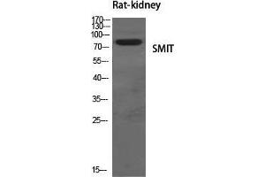 Western Blot (WB) analysis of specific cells using SMIT Polyclonal Antibody. (SLC5A3 抗体  (Internal Region))