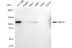 Western blotting analysis using NALP3 antibody (ABIN7799611).