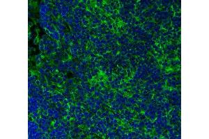 Immunohistochemistry (Paraffin-embedded Sections) (IHC (p)) image for anti-alpha Tubulin (TUBA1) (AA 419-435) antibody (ABIN1742547)