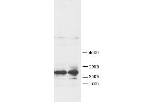 Anti-FGF8 antibody, Western blottingWB: Rat Ovary Tissue Lysate (FGF8 抗体  (C-Term))