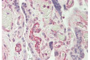 Rabbit Anti-RAPGEF1 antibody Catalog Number: ARP54753 Formalin Fixed Paraffin Embedded Tissue: Human Placenta Primary antibody Concentration: 1:100 Secondary Antibody: Donkey anti-Rabbit-Cy3 Secondary Antibody Concentration: 1:200 Magnification: 20x Exposure Time: 0. (GRF2 抗体  (C-Term))