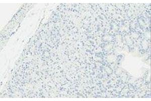 Immunohistochemistry (IHC) image for anti-TLR4 /MD2 Complex antibody (ABIN2665419) (TLR4 /MD2 Complex 抗体)