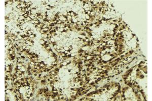 ABIN6273273 at 1/100 staining Human lung tissue by IHC-P. (NFKBIZ 抗体  (Internal Region))