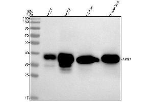 Western blot analysis of Arginase-1/ARG1 using anti-Arginase-1/ARG1 antibody (ABIN3043526).