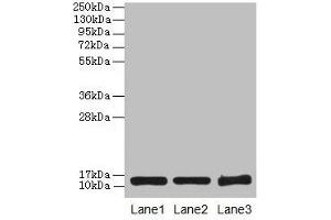 Western blot All lanes: SNCG antibody at 16 μg/mL Lane 1: HT29 whole cell lysate Lane 2: Mouse brain tissue Lane 3: 293T whole cell lysate Secondary Goat polyclonal to rabbit IgG at 1/10000 dilution Predicted band size: 14 kDa Observed band size: 14 kDa (SNCG 抗体  (AA 1-127))