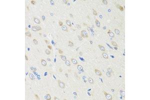 Immunohistochemistry of paraffin-embedded rat brain using CRABP2 antibody. (CRABP2 抗体  (AA 22-94))