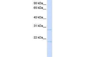 WB Suggested Anti-TCF21 Antibody Titration:  0. (TCF21 抗体  (C-Term))