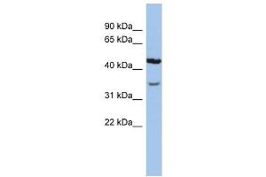 KCNK4 antibody used at 1 ug/ml to detect target protein. (KCNK4 抗体  (N-Term))