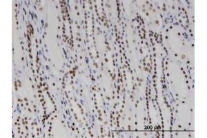 Image no. 1 for anti-DEAD/H (Asp-Glu-Ala-Asp/His) Box Polypeptide 11 (DDX11) (AA 1-970) antibody (ABIN599369) (DDX11 抗体  (AA 1-970))