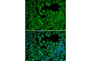 Immunofluorescence analysis of HeLa cells using NET1 antibody (ABIN5970555). (NET1 抗体)
