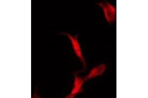 ABIN6272291 staining COLO205 by IF/ICC. (KIF11 抗体  (C-Term))