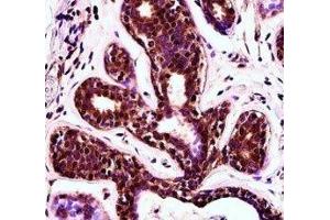 PDCD4 antibody immunohistochemistry analysis in formalin fixed and paraffin embedded human breast tissue. (PDCD4 抗体  (AA 121-149))