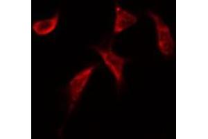 Immunofluorescence (fixed cells) (IF/ICC) image for anti-Activating Transcription Factor 2 (ATF2) (N-Term) antibody (ABIN6260090)