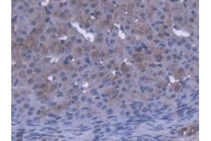 DAB staining on IHC-P; Samples: Mouse Ovary Tissue (OVGP1 抗体  (AA 231-476))