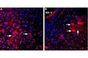 Immunohistochemistry (IHC) image for anti-Solute Carrier Family 16, Member 7 (Monocarboxylic Acid Transporter 2) (SLC16A7) (AA 456-468), (Intracellular) antibody (ABIN7043678)