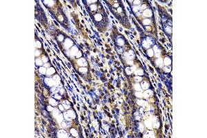 Immunohistochemistry of paraffin-embedded rat ileum using ARID3A antibody (ABIN5975618) at dilution of 1/100 (40x lens). (ARID3A 抗体)