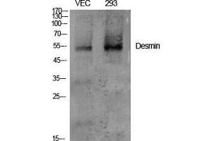 Western Blot (WB) analysis of specific cells using Desmin Polyclonal Antibody.