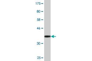 Western Blot detection against Immunogen (36. (RBM12 抗体  (AA 834-932))