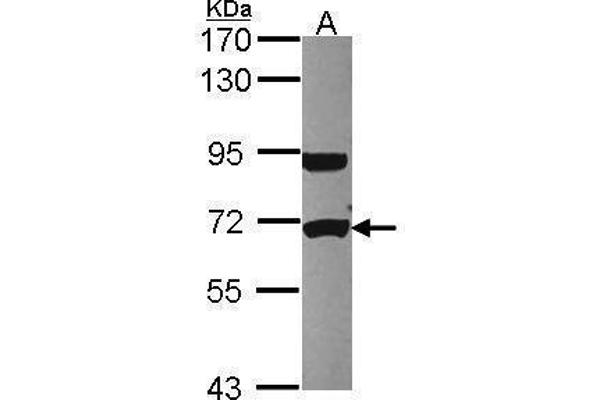 UTP6 抗体  (Center)