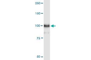 Immunoprecipitation of HOOK1 transfected lysate using anti-HOOK1 MaxPab rabbit polyclonal antibody and Protein A Magnetic Bead , and immunoblotted with HOOK1 purified MaxPab mouse polyclonal antibody (B01P) . (HOOK1 抗体  (AA 1-728))