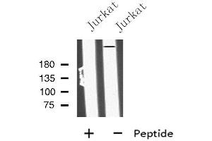 Western blot analysis of MIA3 using Jurkat whole cell lysates
