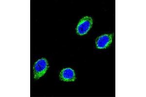 Confocal immunofluorescent analysis of CCHCR1 Antibody (Center) (ABIN652467 and ABIN2842318) with 293 cell followed by Alexa Fluor® 488-conjugated goat anti-rabbit lgG (green). (CCHCR1 抗体  (AA 599-627))