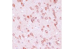 Immunohistochemistry of paraffin-embedded rat brain using RPL21 antibody (ABIN7269996) at dilution of 1:100 (40x lens). (RPL21 抗体  (AA 1-160))