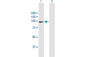 Western Blot analysis of PDCD6IP expression in transfected 293T cell line by PDCD6IP MaxPab polyclonal antibody.