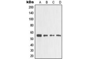 Western blot analysis of MMP3 expression in HeLa (A), A431 (B), mouse heart (C), PC12 (D) whole cell lysates. (MMP3 抗体  (C-Term))