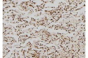 Immunohistochemistry (IHC) image for anti-Glucocorticoid Receptor DNA Binding Factor 1 (GRLF1) (pTyr1105) antibody (ABIN6256617)