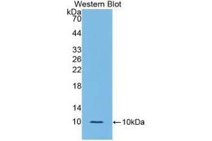 Detection of Recombinant IL6R, Rat using Polyclonal Antibody to Interleukin 6 Receptor (IL6R) (IL-6 Receptor 抗体  (AA 385-462))