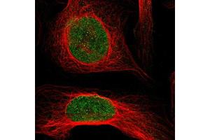 Immunofluorescent staining of U-2 OS cells using KAT5 polyclonal antibody  shows positivity in nucleus (green) but excluded from the nucleoli. (KAT5 抗体  (AA 150-286))