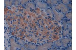 IHC-P analysis of Rat pancrease Tissue, with DAB staining. (IL2 Receptor beta 抗体  (AA 27-239))