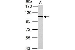 WB Image alpha Actinin 4 antibody [N2C1], Internal detects alpha Actinin 4 protein by Western blot analysis. (alpha Actinin 4 抗体)
