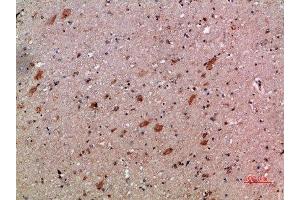 Immunohistochemistry (IHC) image for anti-Chemokine (C-X-C Motif) Ligand 12 (CXCL12) (AA 31-80) antibody (ABIN7189487)