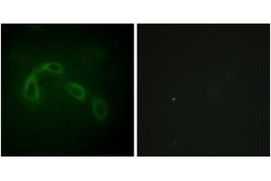 Immunofluorescence analysis of HeLa cells, using PAK1/2 (Ab-199) Antibody. (PAK1/2 抗体  (AA 165-214))