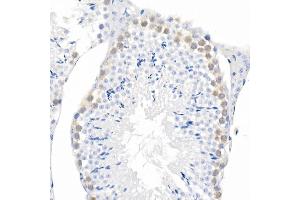 Immunohistochemistry of paraffin-embedded mouse liver using Phospho--S473 Rabbit mAb (ABIN6135179, ABIN6135970, ABIN6135971 and ABIN7101880) at dilution of 1:100 (40x lens). (AKT1 抗体  (pSer473))
