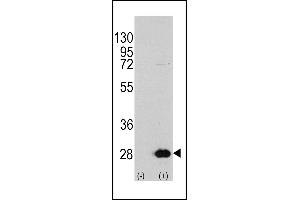 Western blot analysis of HSPB1 (arrow) using rabbit polyclonal HSPB1 Antibody (S78) (R). (HSP27 抗体  (AA 56-85))