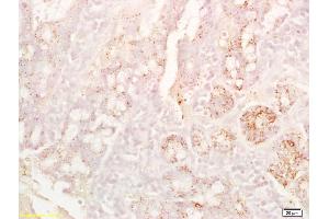 Formalin-fixed and paraffin embedded rat colon labeled with Anti-CD8B Polyclonal Antibody, Unconjugated (ABIN1387300) at 1:200 followed by conjugation to the secondary antibody and DAB staining. (CD8B 抗体  (AA 51-150))