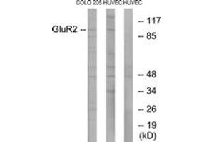 Western blot analysis of extracts from COLO205/HuvEC cells, using GluR2 (Ab-880) Antibody. (GRIA2 抗体  (AA 834-883))
