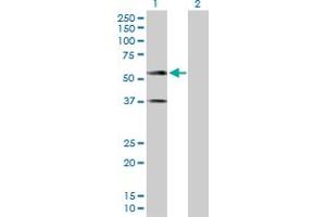 Western Blot analysis of CADM1 expression in transfected 293T cell line by CADM1 MaxPab polyclonal antibody. (CADM1 抗体  (AA 1-387))