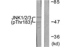 Western blot analysis of extracts from 293 cells treated with UV 5', using JNK1/2/3 (Phospho-Thr183+Tyr185) Antibody. (JNK 抗体  (pThr183))