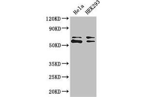 Western Blot Positive WB detected in: Hela whole cell lysate, HEK293 whole cell lysate All lanes: COASY antibody at 3. (COASY 抗体  (AA 453-546))