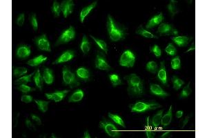 Immunofluorescence of monoclonal antibody to TES on HeLa cell. (TES 抗体  (AA 1-421))