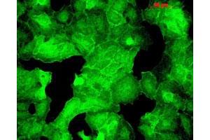 Immunofluorescence staining in HaCaT cells with Psd monoclonal antibody, clone 6G6 .