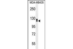 TTLL13 Antibody (Center) (ABIN655432 and ABIN2844968) western blot analysis in MDA-M cell line lysates (35 μg/lane). (TTLL13 抗体  (AA 461-490))