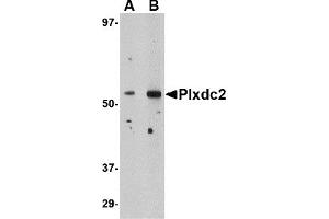 Western Blotting (WB) image for anti-Plexin Domain Containing 2 (PLXDC2) (N-Term) antibody (ABIN1031520) (PLXDC2 抗体  (N-Term))