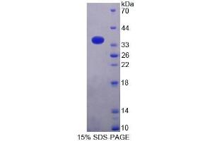 SDS-PAGE analysis of Mouse MRPL2 Protein. (MRPL2 蛋白)